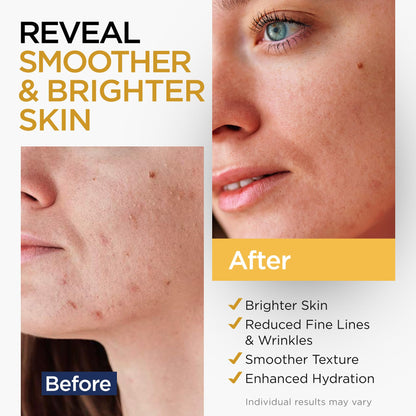 Vitamin C Serum for Face with Stem Cells Hyaluronic Acid Vitamin E Aloe Vera Anti-Aging Face Serum Supports Skin Health - dailyvitalstore
