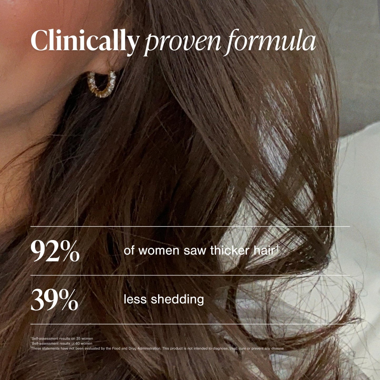 Viviscal Hair Growth Supplements For Women For Thicker, Fuller Hair, Nourishes Thinning & Loss, With Proprietary Collagen Complex, - dailyvitalstore