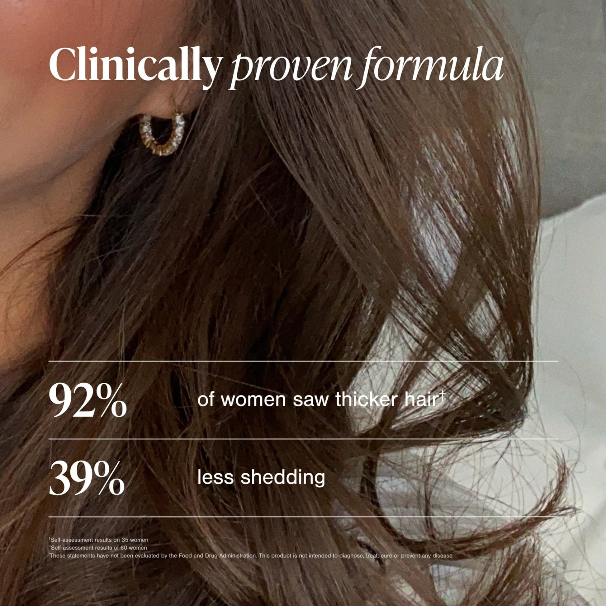 Viviscal Hair Growth Supplements For Women For Thicker, Fuller Hair, Nourishes Thinning & Loss, With Proprietary Collagen Complex, - dailyvitalstore
