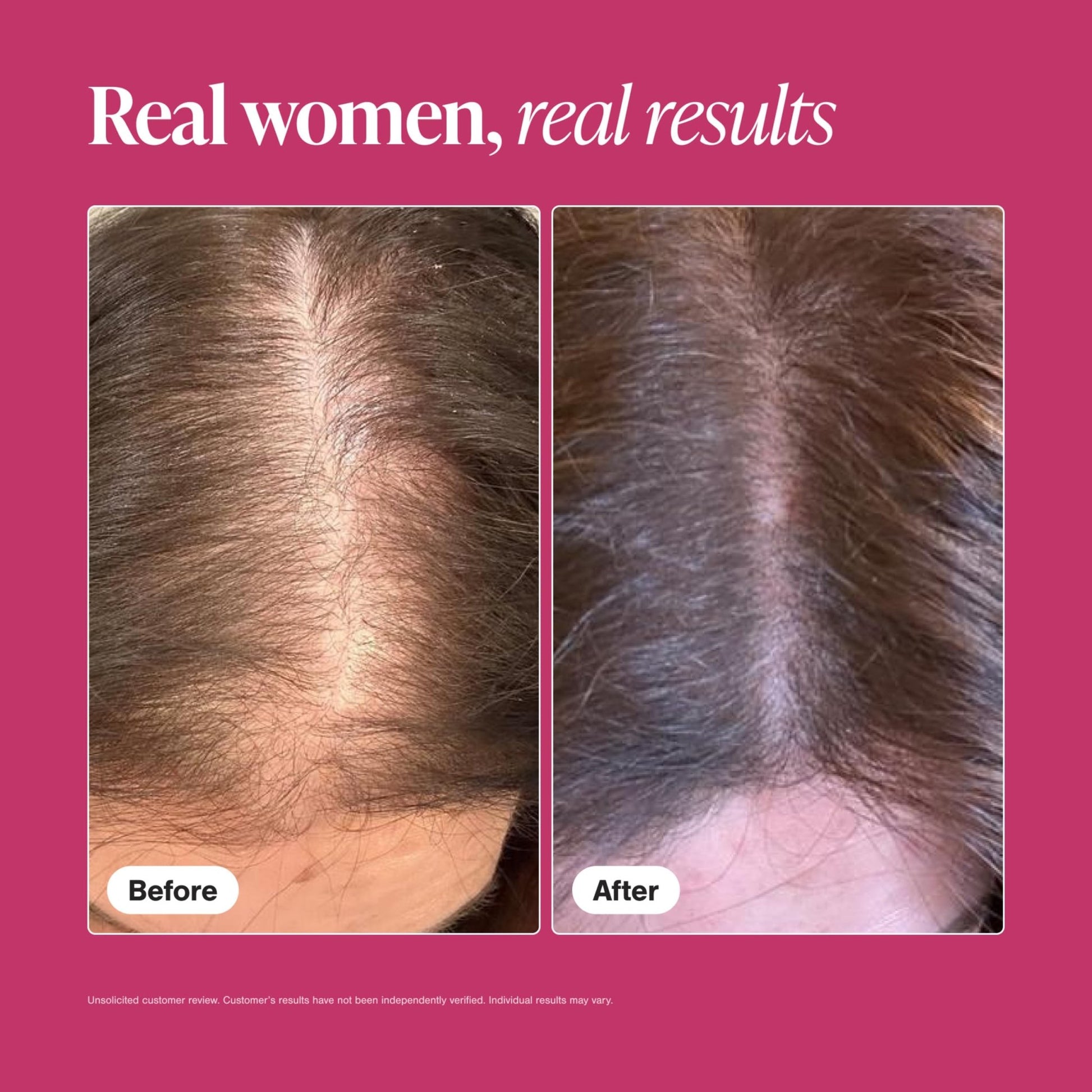 Viviscal Hair Growth Supplements For Women For Thicker, Fuller Hair, Nourishes Thinning & Loss, With Proprietary Collagen Complex, - dailyvitalstore