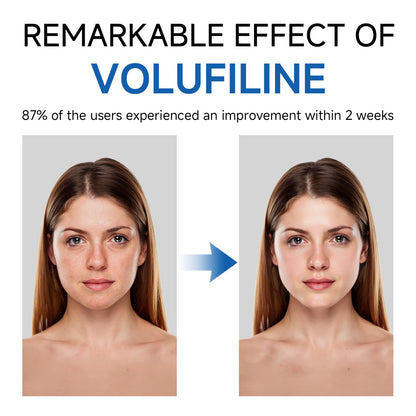 Volufiline Serum, Volufiline Under Eye Serum, Cosmetic Grade Ampoule for Skin Elasticity Improvement, Face & Body Fine Lines, Hydrating Texture, 10ml*2 - dailyvitalstore