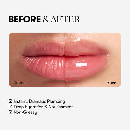 VTCOSMETICS Reedle Shot Lip Plumper, 0.15 oz (4.3 g), Moisturizing, Transparent, Lip Gloss, Fragrance-free, Korean Cosmetics (Expert) - dailyvitalstore