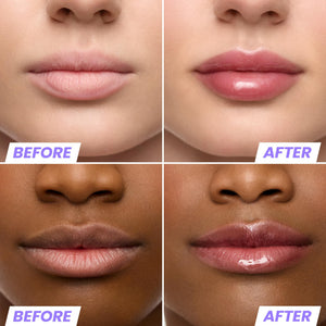 Wonderskin Lip Oil Rehab Serum - Tinted Lip Oil, Hydrating, Moisturizing, and Non-Sticky Deep Red Tint Serum for Dry Lips (Honey) - dailyvitalstore