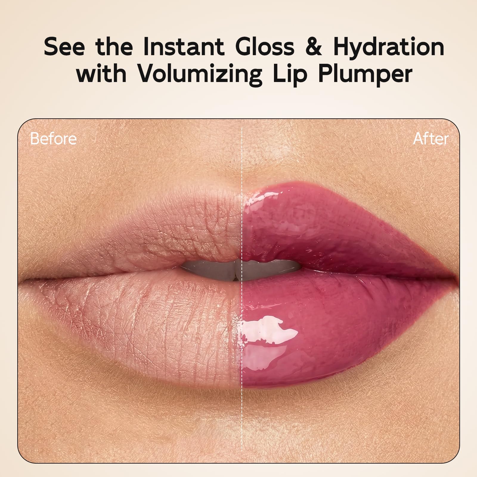 YouthVibe 5% Volufiline Lip Plumper, Nourishing & Anti Aging Over Time with Squalane, Shea Butter, Collagen, Peptide & PDRN - No Burning, No Tingling for Gentle Daily Plumping - dailyvitalstore