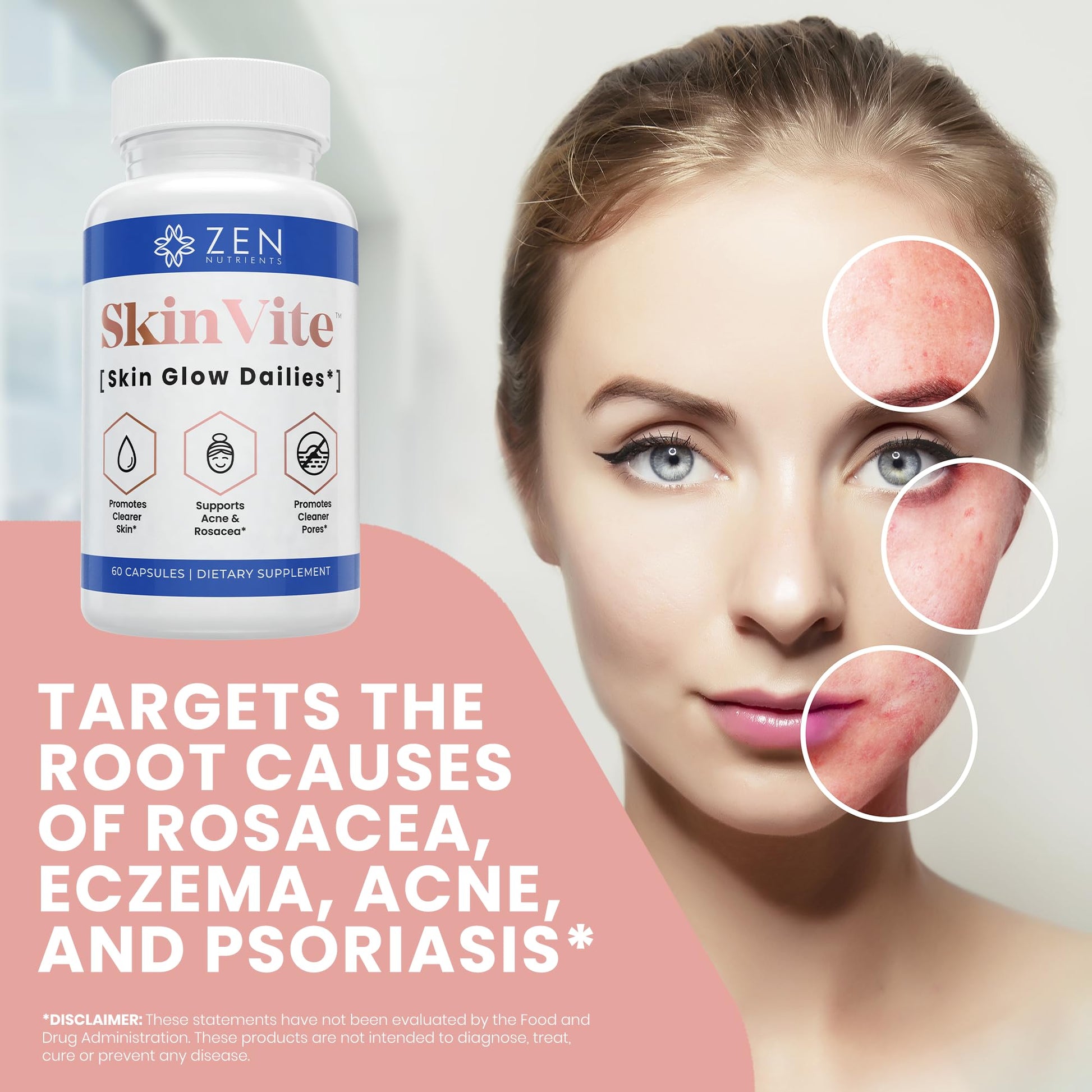 Zen Nutrients SkinVite Natural Skin Supplement for Women, Men & Teens - Hormonal Breakouts & Clear Skin Support Supplement - Detoxifying Vitamin for Acne and Digestion Support - dailyvitalstore
